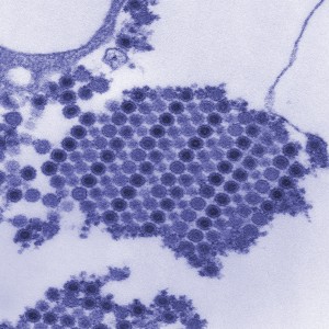 CDCimg1-lg